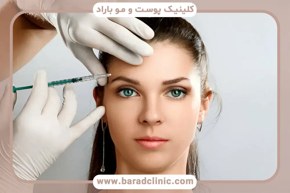 ماندگاری بوتاکس ابرو
