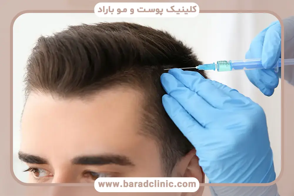 عکس قبل و بعد مزوتراپی مو