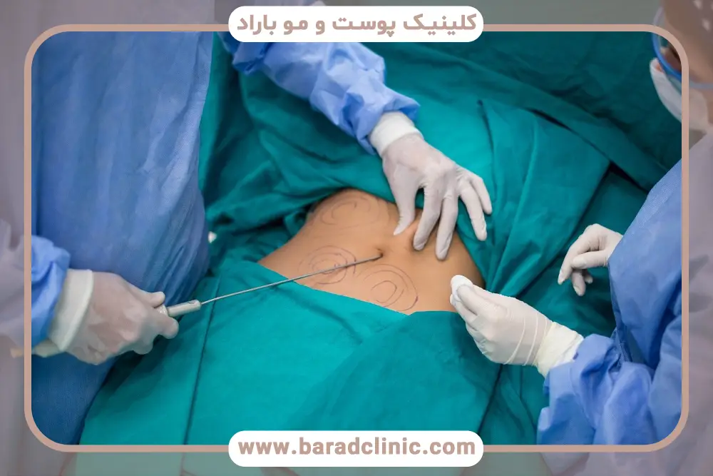 عمل لاغری