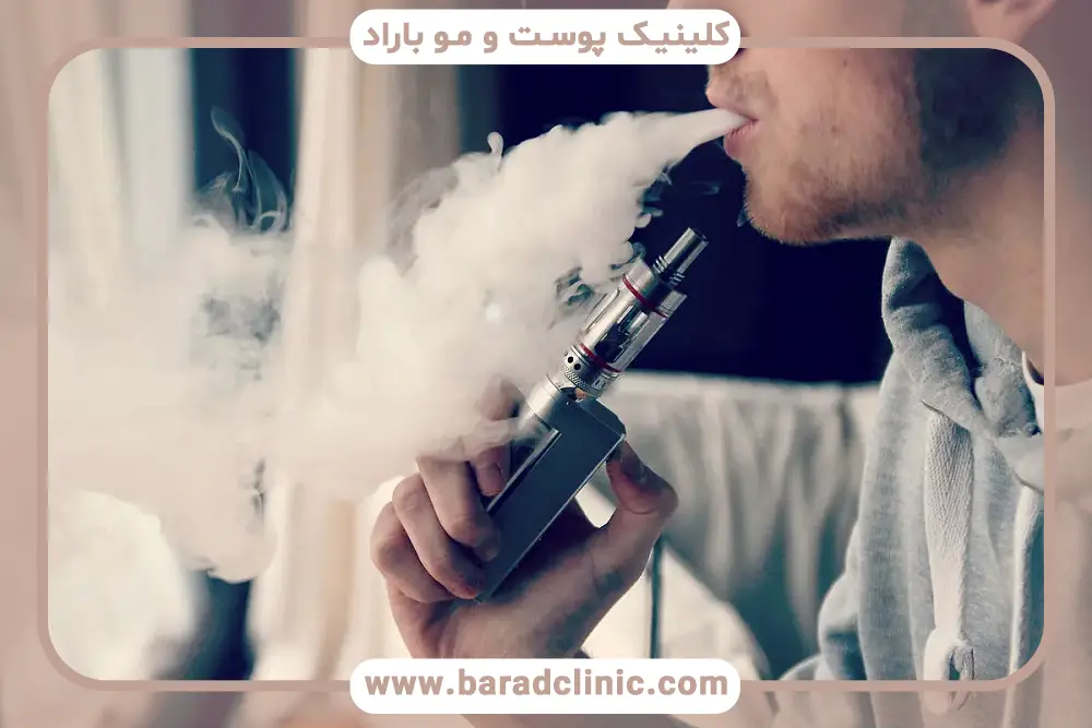کشیدن یک نخ سیگار بعد از کاشت مو