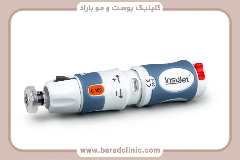 کاشت مو بدون سوزن بی حسی