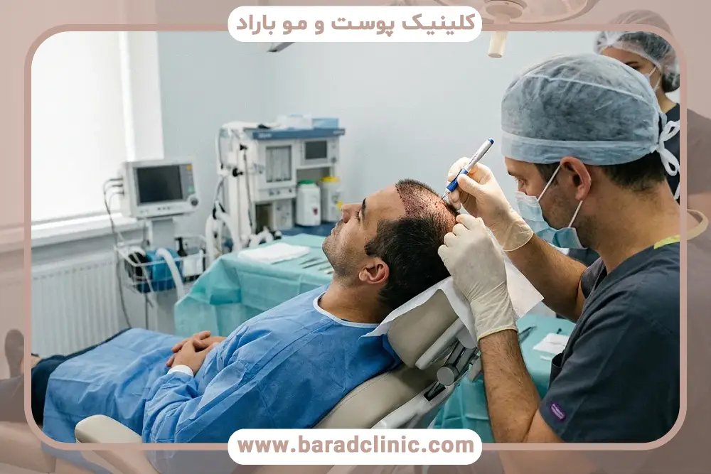 کاشت مو در شیراز بهتر است یا تهران