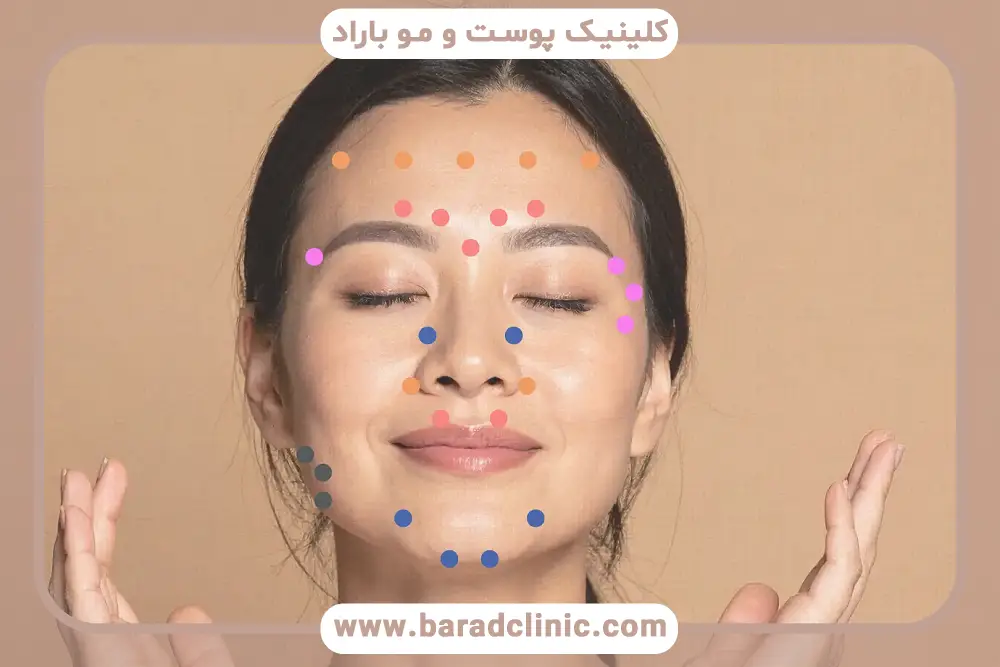 مراقبت های بعد از بوتاکس صورت
