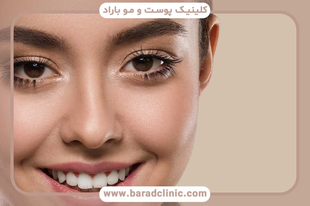 آیا کاشت ابرو دائمی است؟