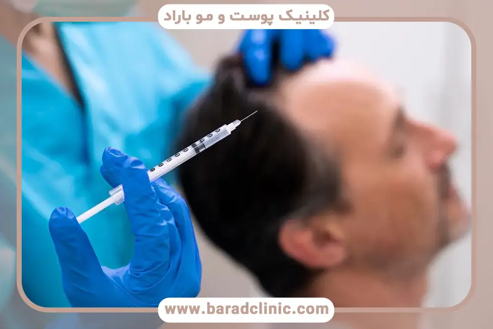 پی آر پی مو چند درصد جواب میده؟ بررسی تعداد جلسات