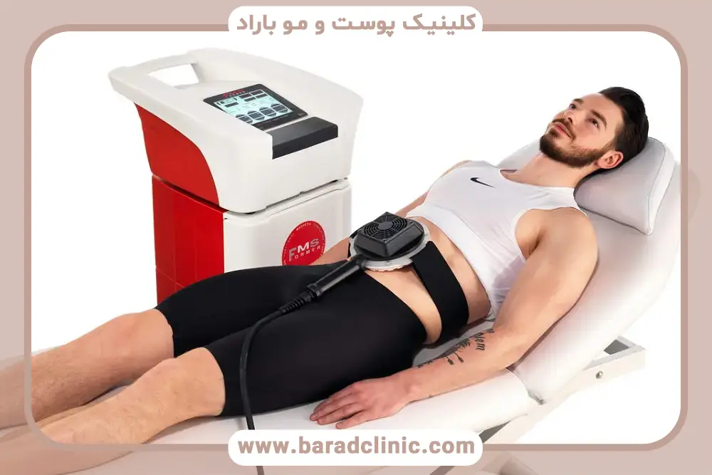 کرایولیپولیز بهترین دستگاه لاغری شکم 