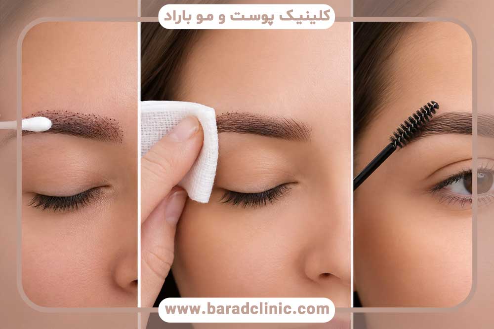 آبپاشی ابرو بعد از کاشت