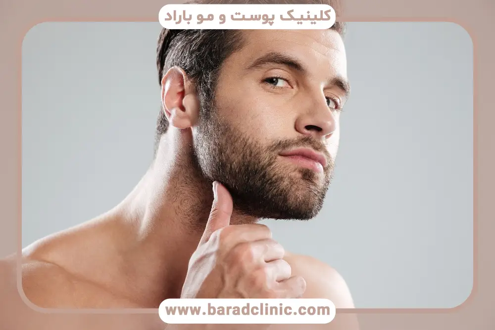 اهمیت شستشو بعد از کاشت ریش