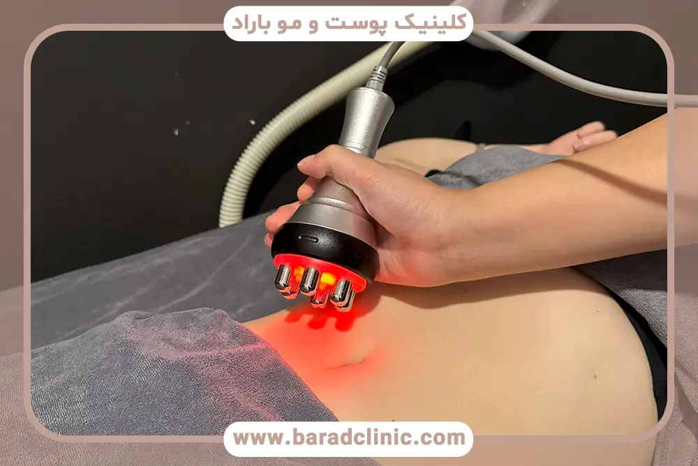 آشنایی با بهترین دستگاه لاغری شکم و پلو