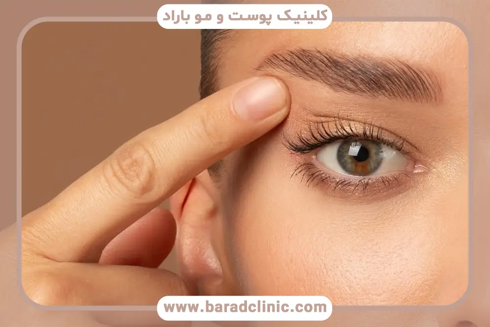 علائم افتادگی ناگهانی پلک 