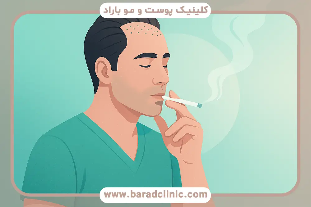 بررسی کشیدن یک نخ سیگار بعد از کاشت مو 