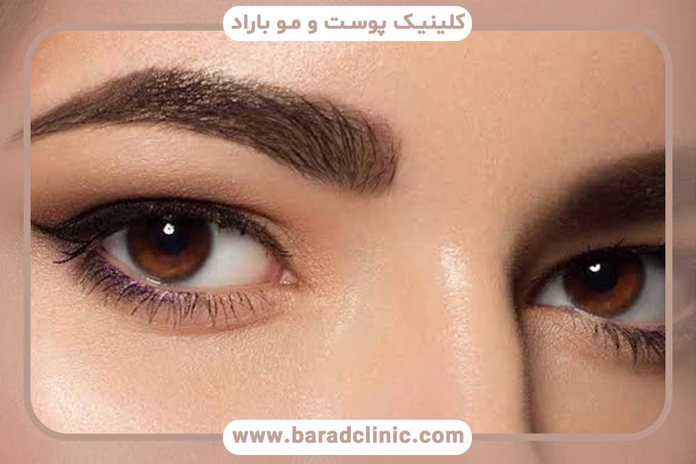 عوامل موثر بر تعداد فولیکول‌های لازم برای کاشت ابرو