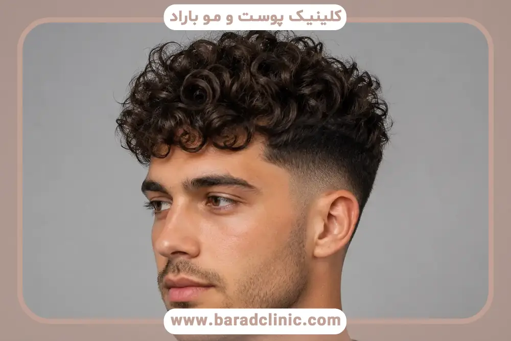 بررسی درصد موفقیت کاشت مو از ریش 