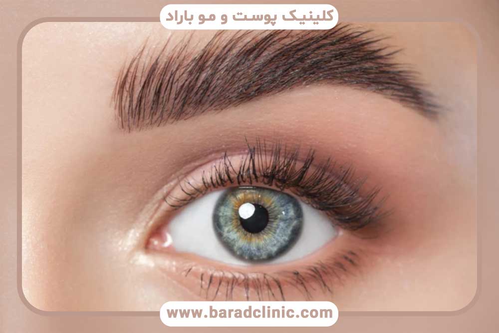 سن مناسب کاشت ابرو
