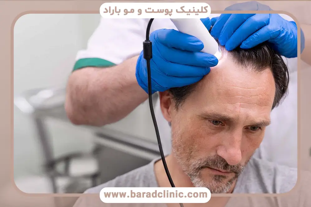 دقت کاشت مو با دستگاه بهتر است یا با دست؟
