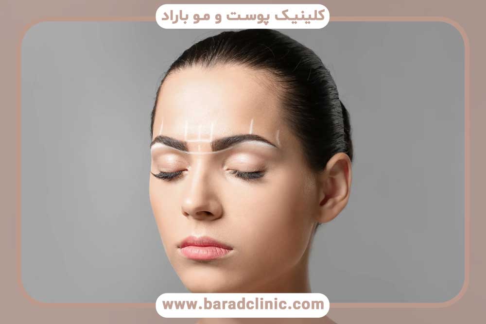 عوامل موثر بر مدت زمان کاشت ابرو