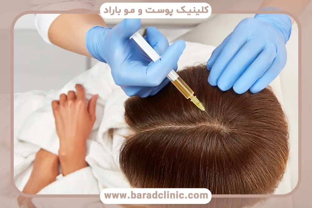 پی آر پی مو بهتر است یا مزوتراپی؟ مقایسه کلی