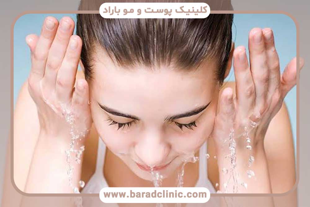 مزایای شستشو بعد از کاشت ابرو