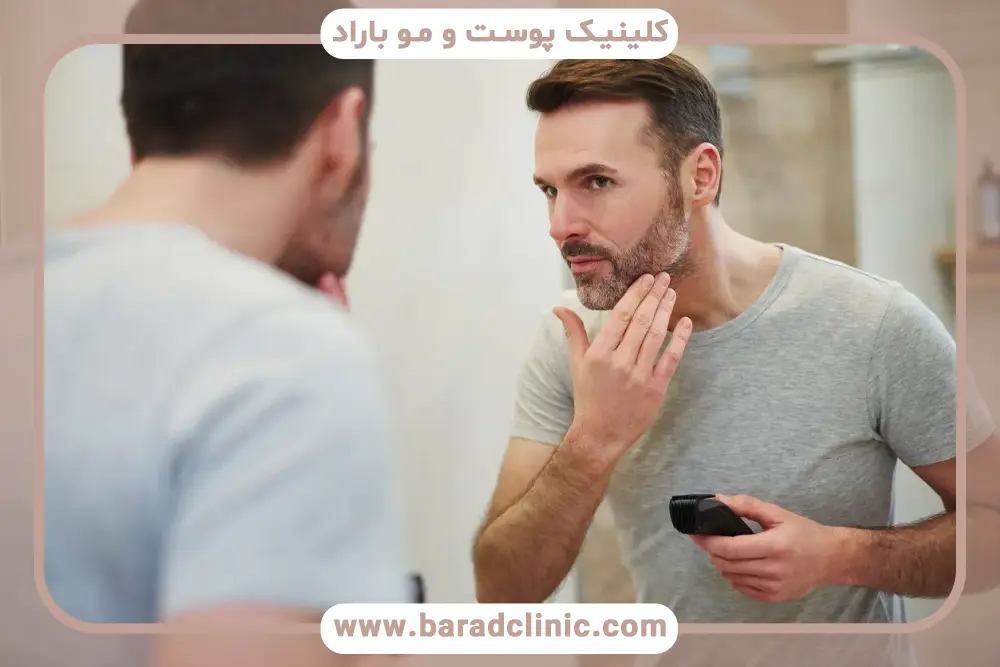 انتخاب شوینده برای شستشو بعد از کاشت ریش
