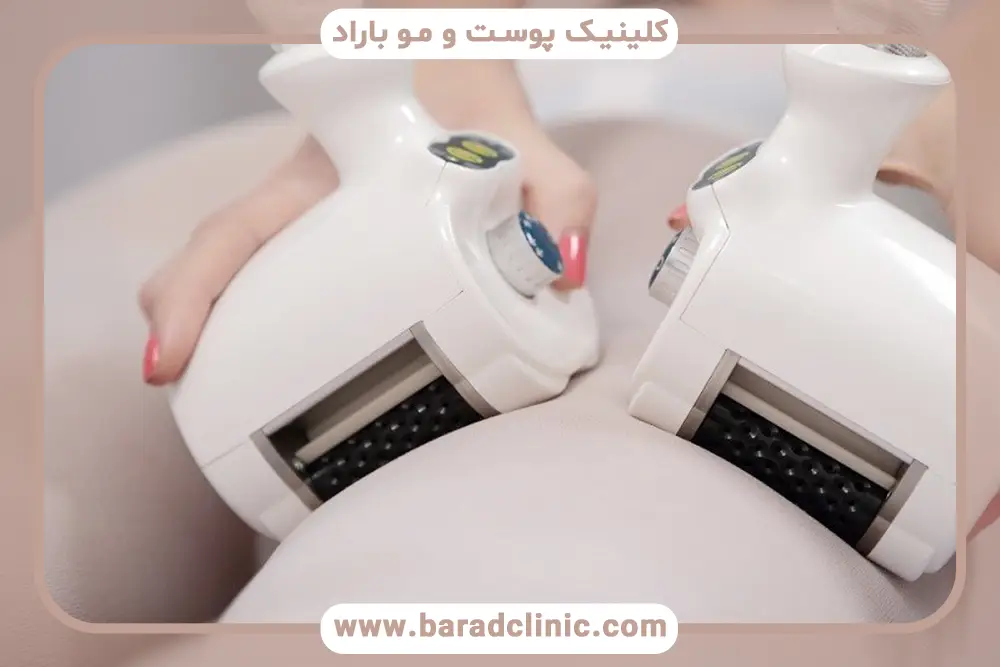کرایولیپولیز بهترین دستگاه لاغری شکم و پلو