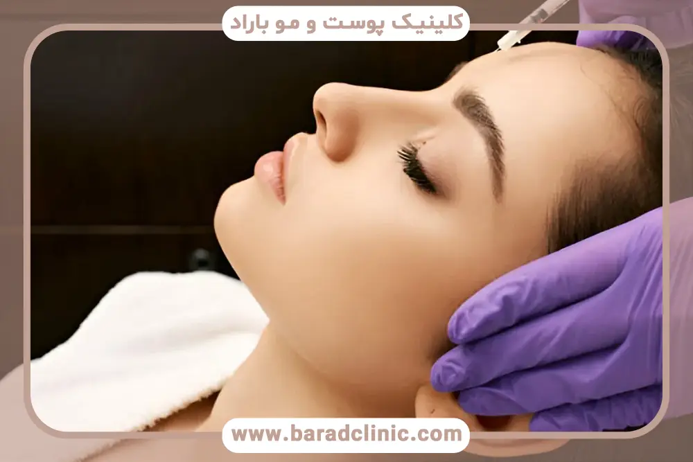 تاثیر برند روی ماندگاری بوتاکس ابرو 