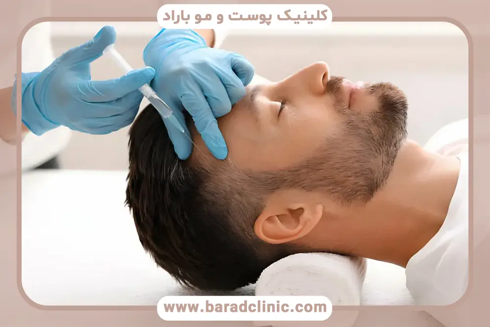 موفقیت نتایج در عکس قبل و بعد مزوتراپی مو 