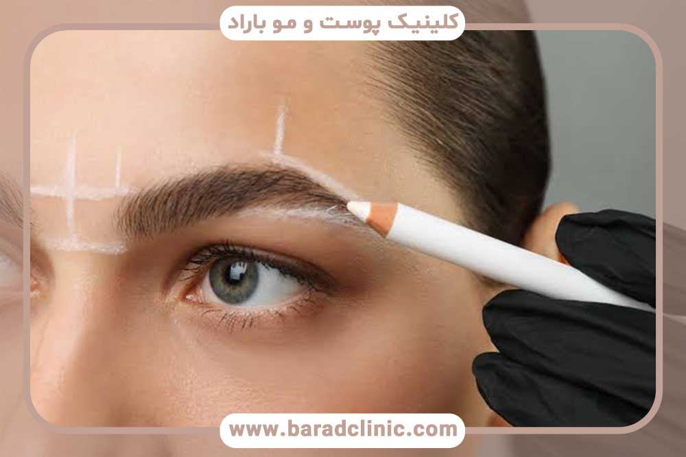 برداشت مو برای کاشت ابرو