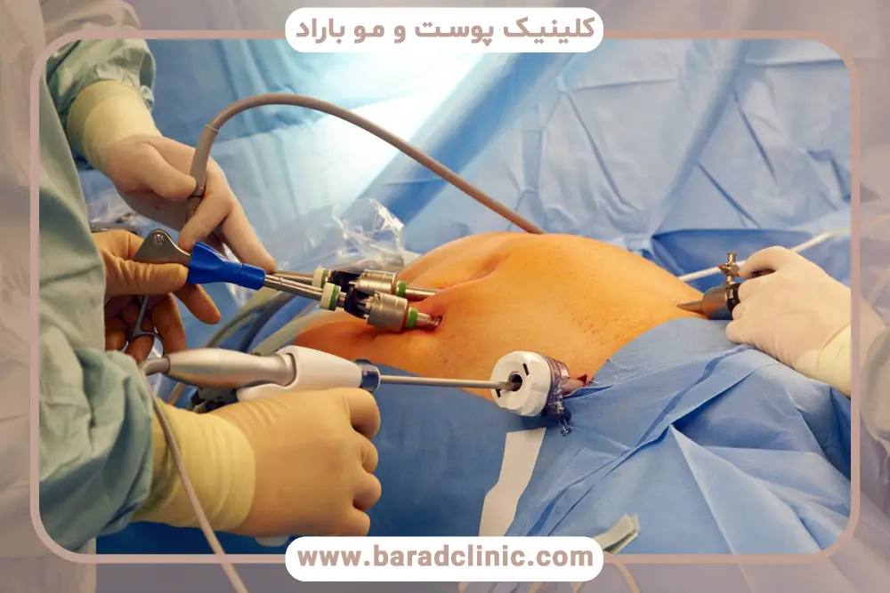مراقبت از زخم‌ها بعد از عمل لاغری 