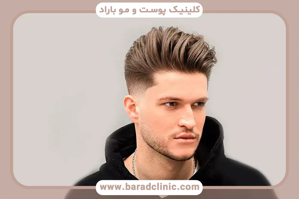 تاثیر جنس گرافت روی درصد موفقیت کاشت مو از ریش 