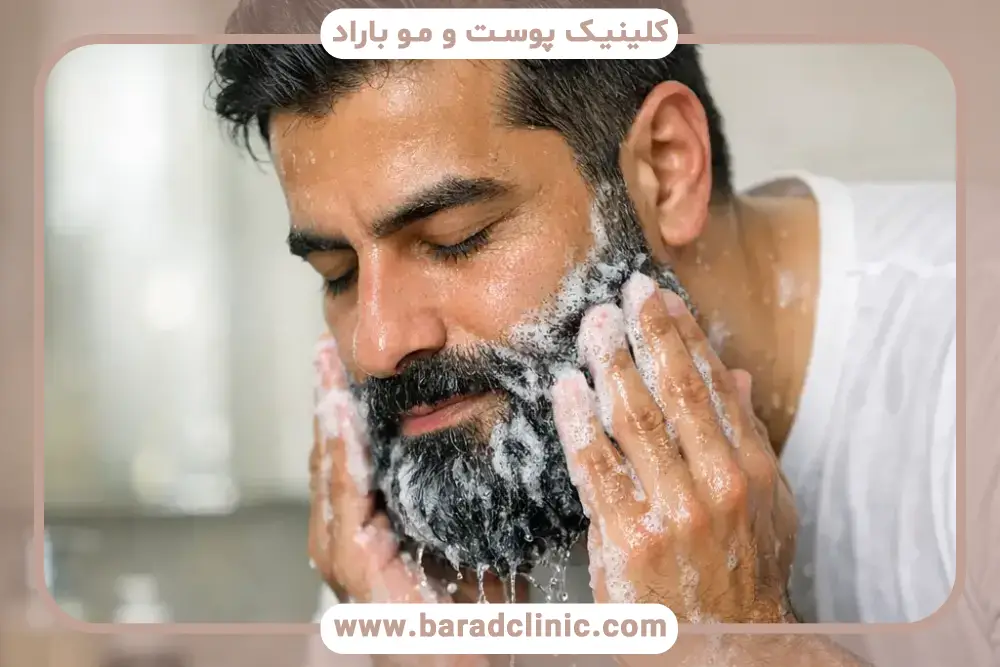 دلایل فولیکولیت ریش