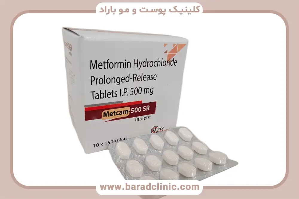 متفورمین کاشت مو و کاهش ریزش