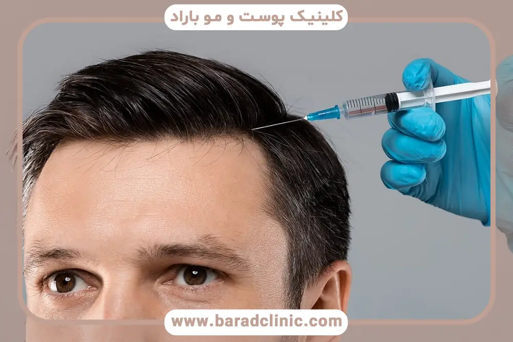 پی آر پی مو بهتر است یا مزوتراپی؟ مقایسه عوارض جانبی