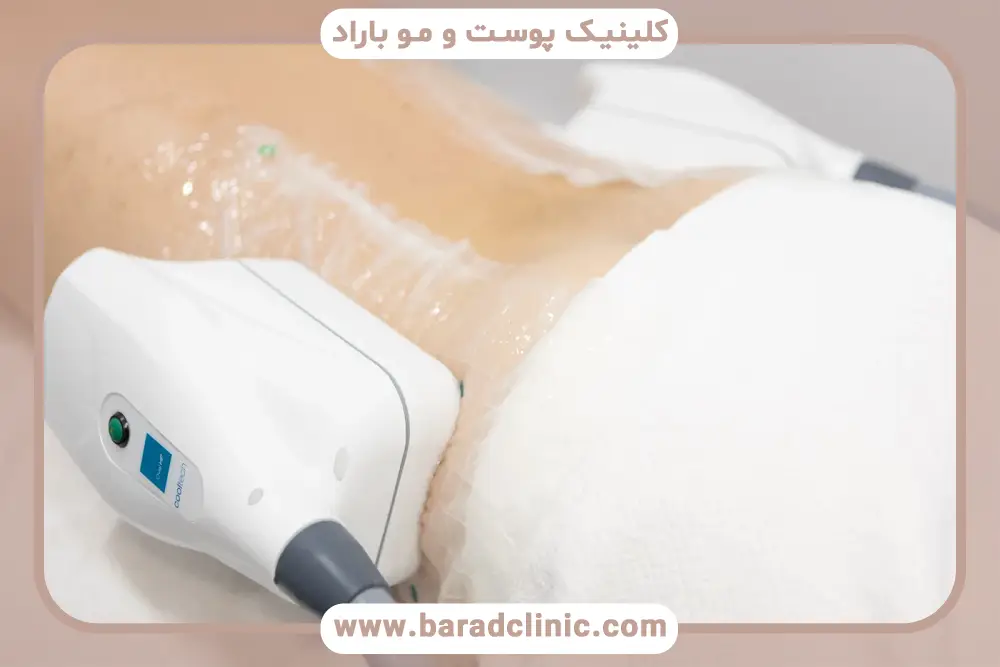 مقایسه بهترین دستگاه لاغری شکم 