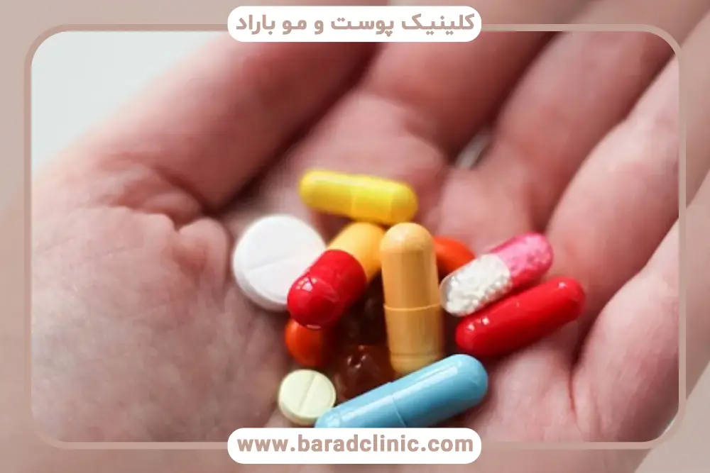 تفاوت قرص برای کاشت مو برای زنان و مردان