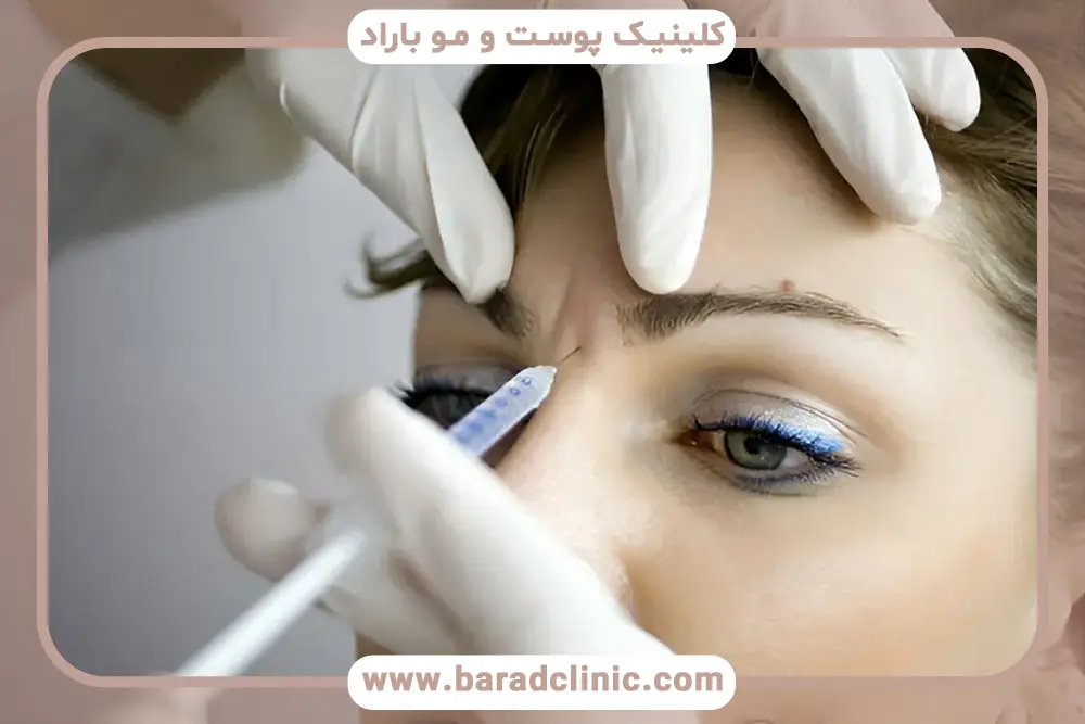 راهکارهای افزایش ماندگاری بوتاکس ابرو 