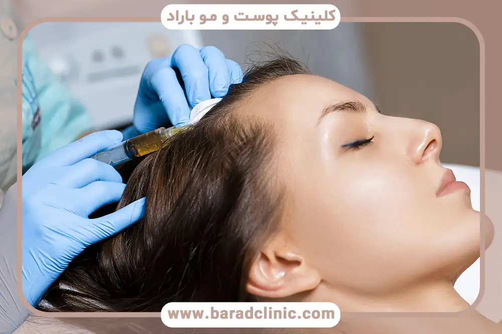 تفاوت عکس قبل و بعد مزوتراپی مو با روش‌های دیگر
