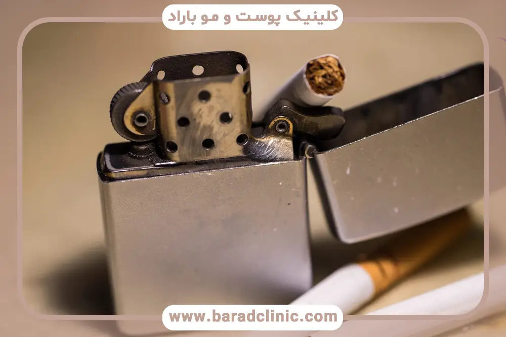 اقدامات مهم بعد از کشیدن یک نخ سیگار بعد از کاشت مو 