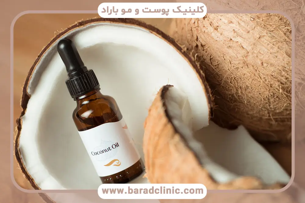 ویژگیهای روغن نارگیل برای ریش اصل