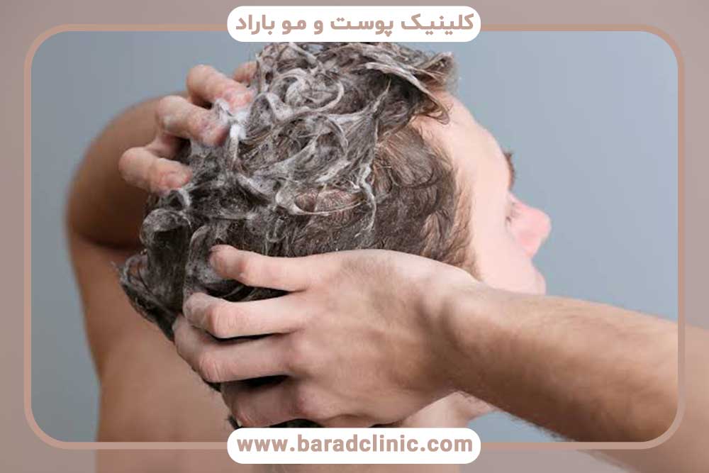 فیلم شستن بخیه سر بعد از کاشت ابرو