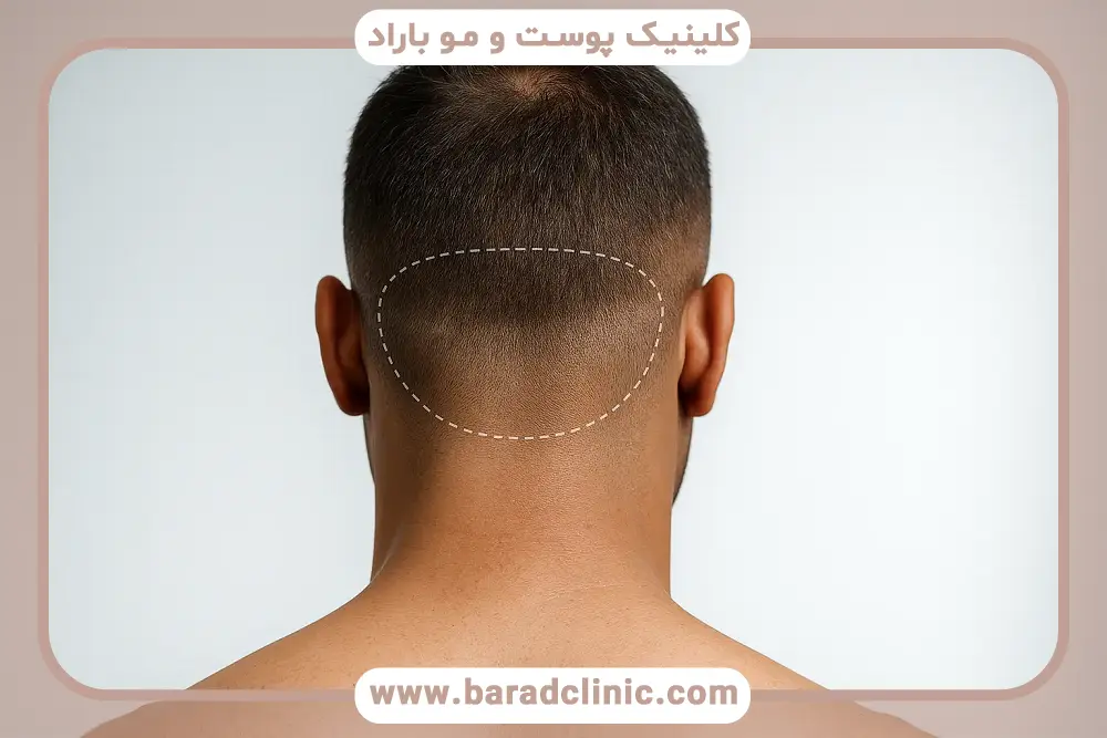 از کجا بفهمیم بانک موی خوبی داریم؟