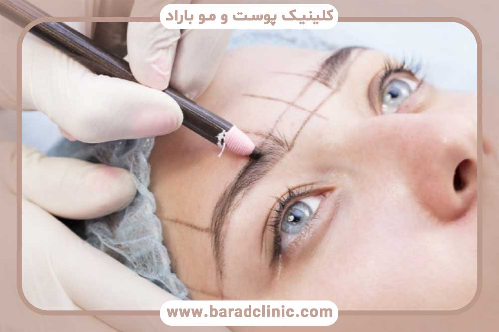 بهترین کلینیک کاشت ابرو در تهران