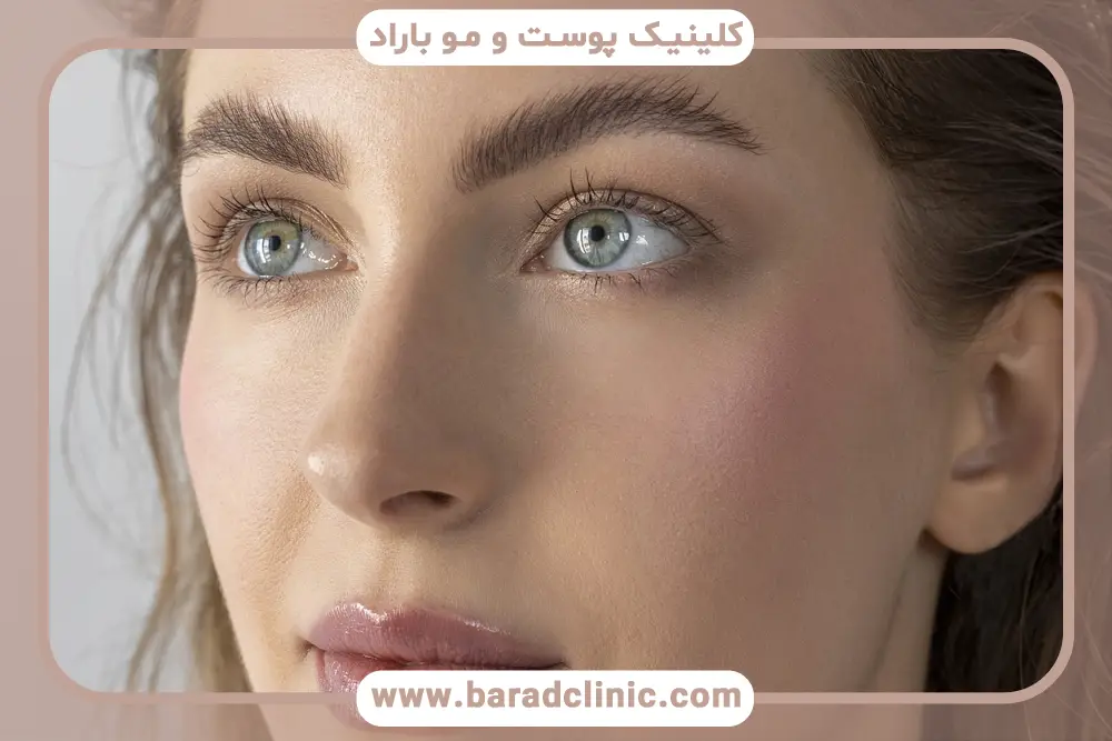 تفاوت بلفاروپلاستی و لیفت ابرو