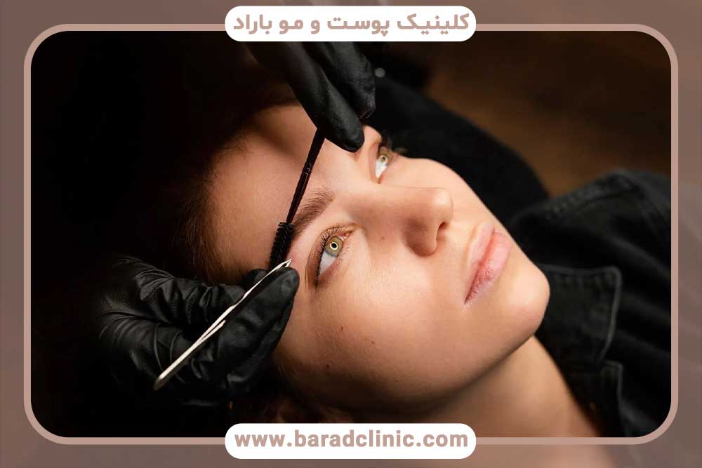 متخصص کاشت ابرو در تهران