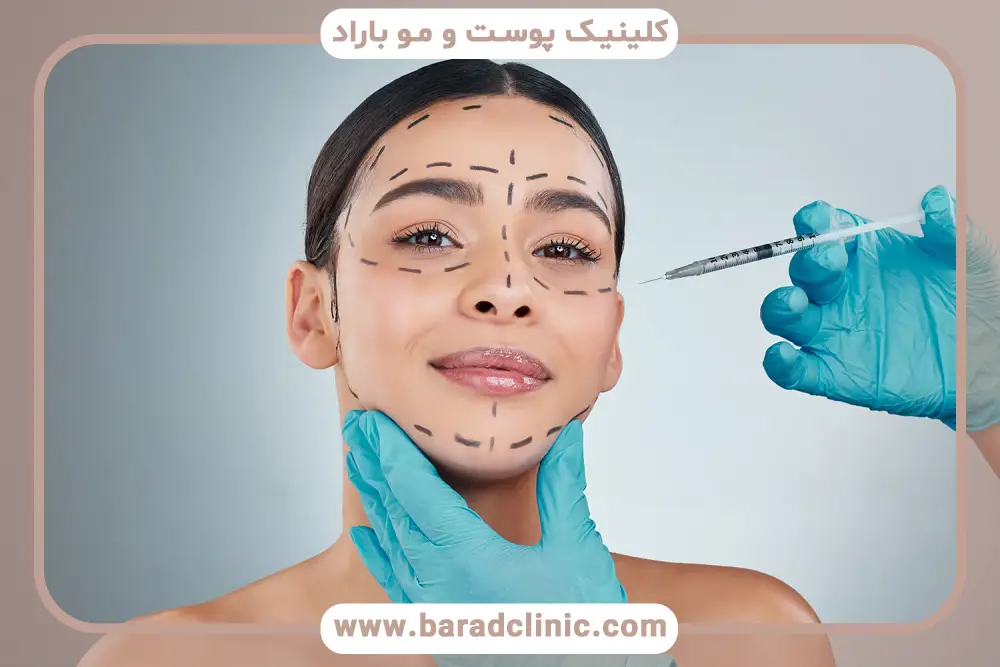 فواید بوتاکس صورت