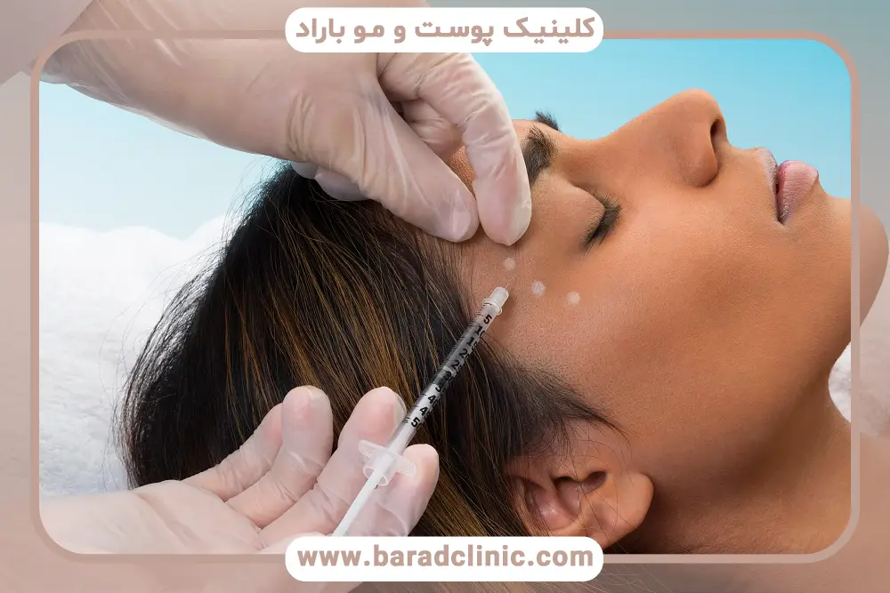 هزینه بوتاکس دائمی