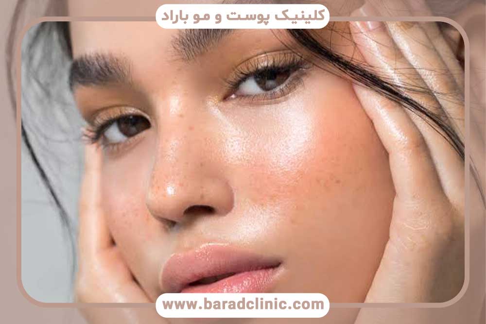 نتایج کاشت ابرو در طول یک سال