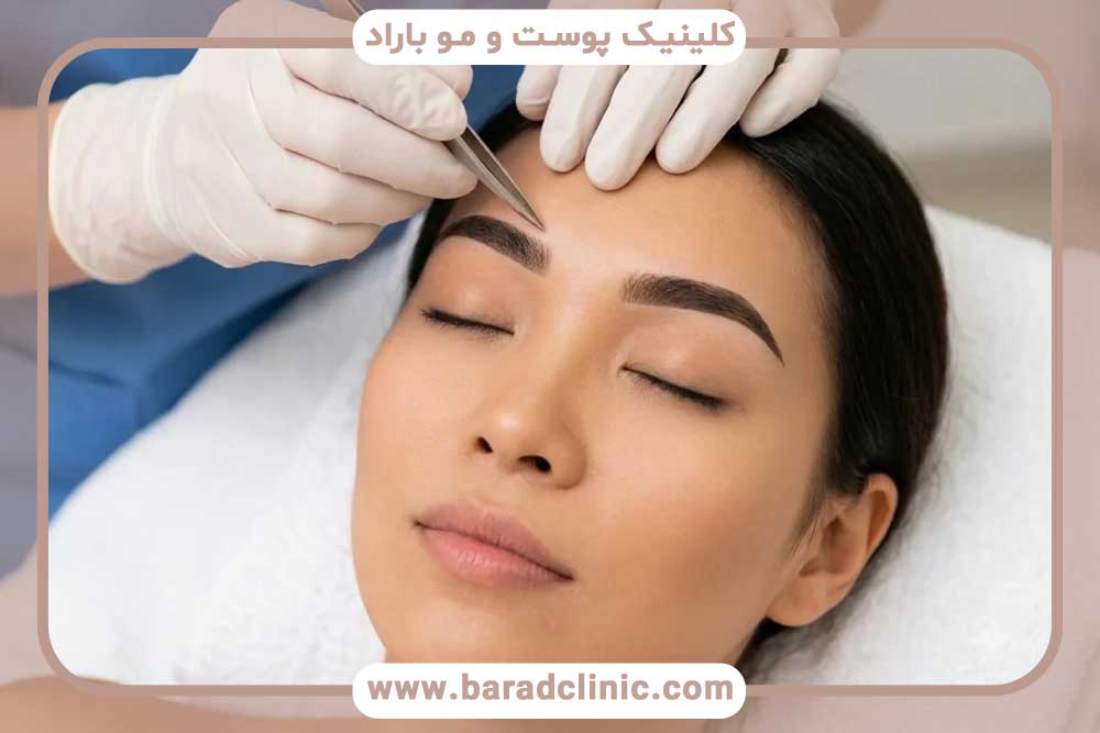 روش‌های کاشت ابرو