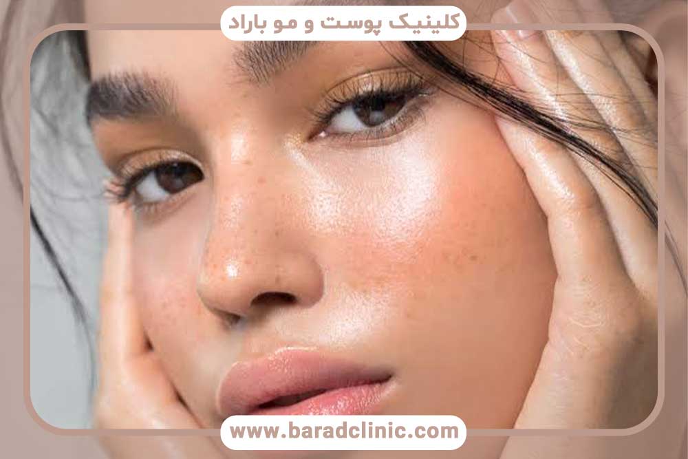 ده روز بعد از کاشت ابرو