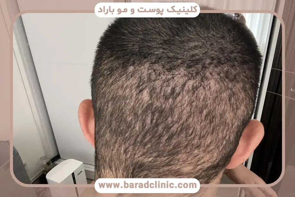 بانک موی ضعیف