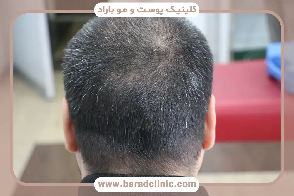 نحوه ارزیابی بانک مو
